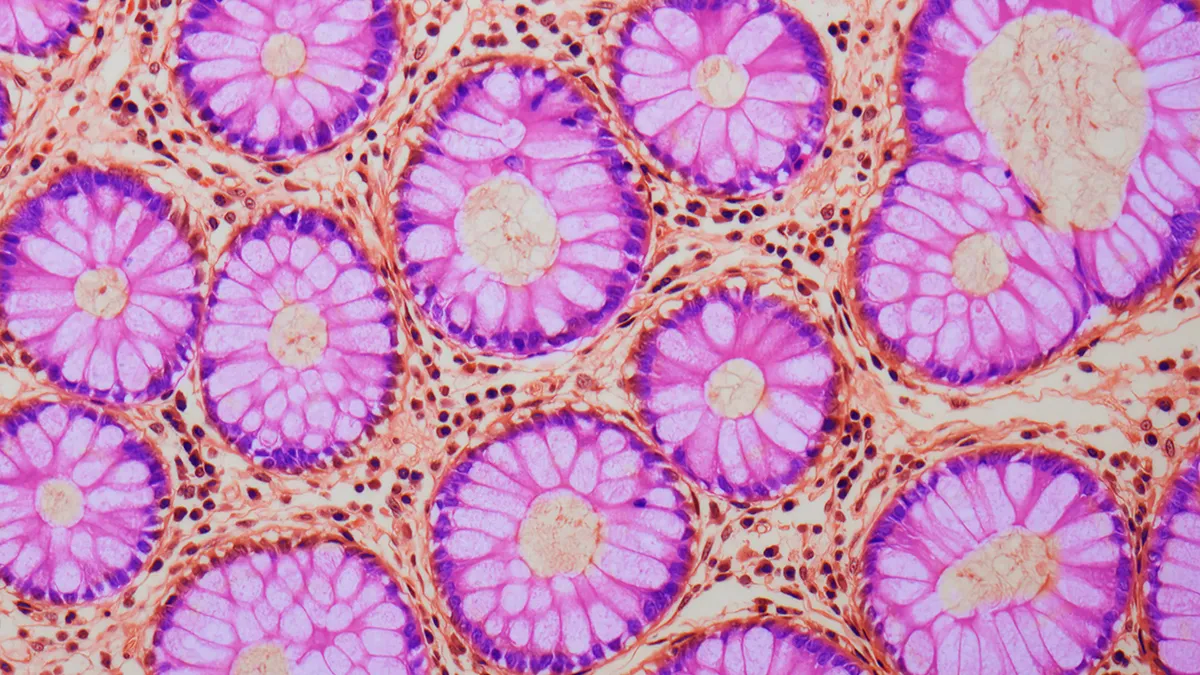 肠道微观结构示意图